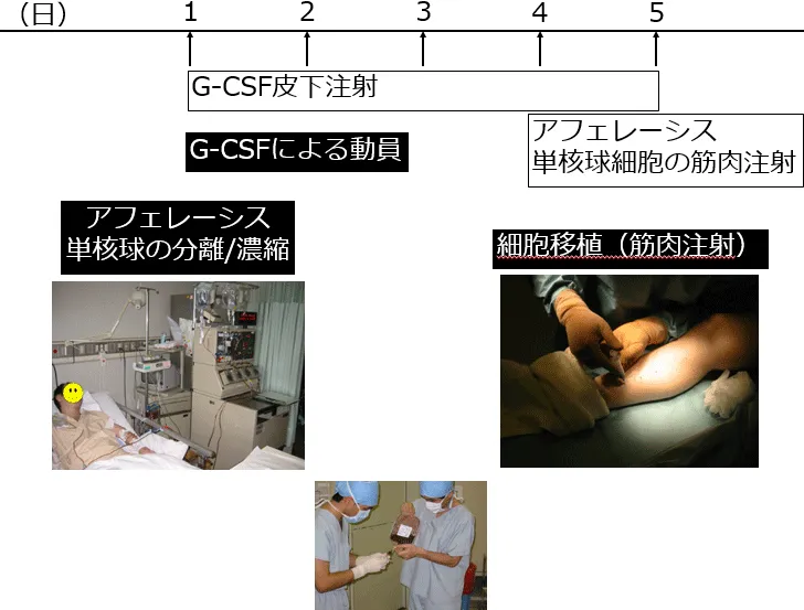 血管再生治療の実際